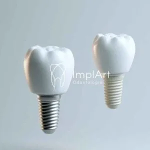 Estrutura da Clínica Odontológica ImplArt
